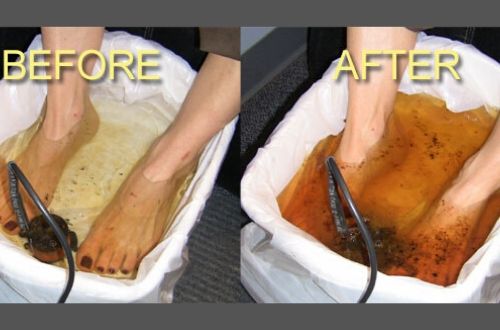 Read more about the article Detox Foot Bath Scam